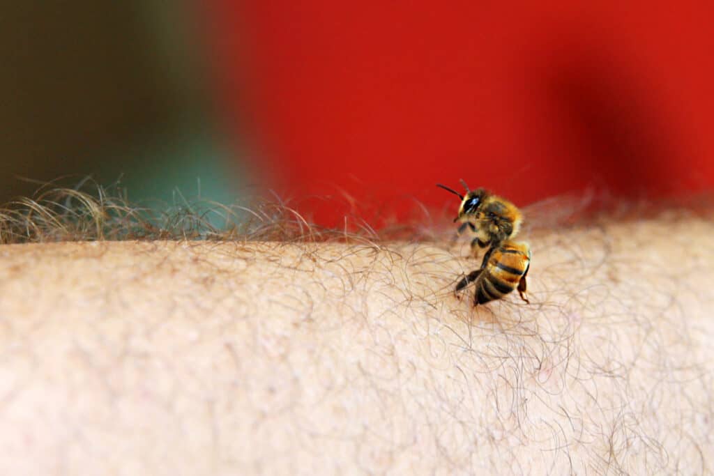 bee stinging a man